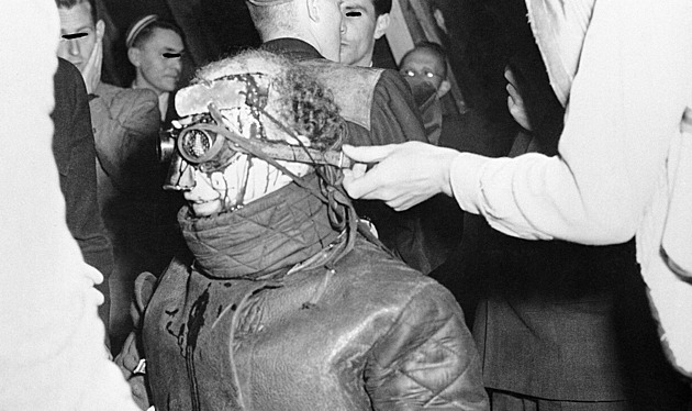 Jako z hororu: jizvu jako odznak cti vyráběly buršácké souboje