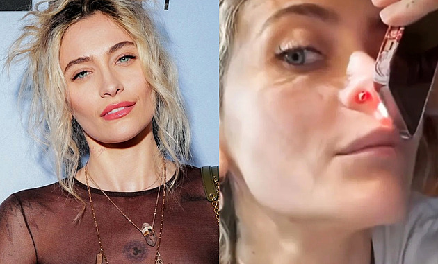 Děti, neberte drogy, radí Jacksonová. Ukázala díru v nosní přepážce po šňupání