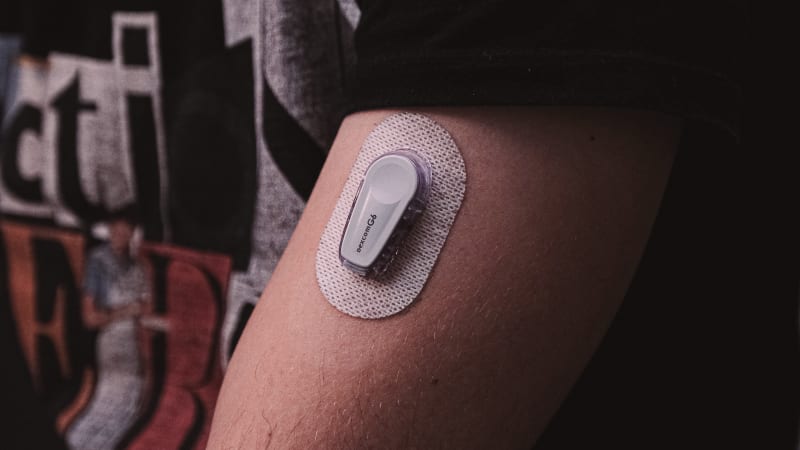 Senzory změnily léčbu cukrovky. Na revoluční technologii dosáhne část diabetiků 2. typu