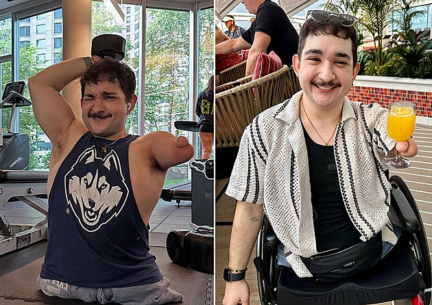 Nemá nohy a ruku, ale život bere mladý muž s úsměvem